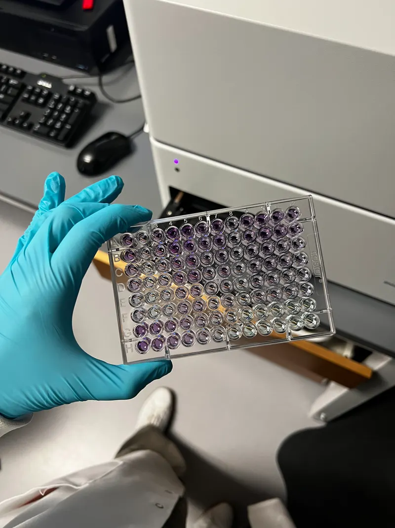 Marta holding a clear 96-well microplate with purple liquids following a protein assay.